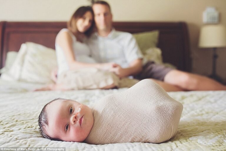 Historia prekëse e bebes që nuk do të rritet kurrë (Foto)