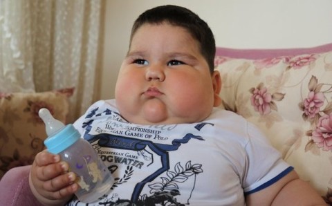 Vetëm 1 vjeҫ e gjysmë dhe peshon 32 kg, historia e vogëlushit me një sëmundje të rrallë