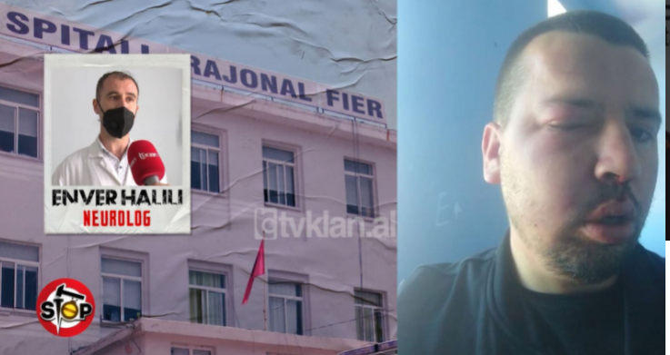 Katër mjekë në Spitalin e Fierit e rrahin brutalisht të birin e pacientit