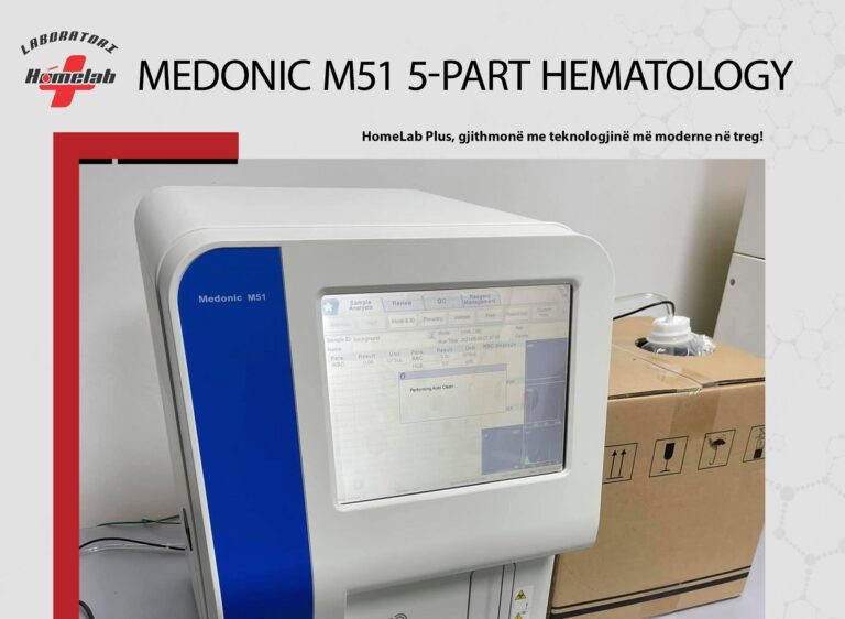 HomeLab Plus pajiset me teknologjinë e fundit për analizat hematologjike “Medonic M51 5-part”