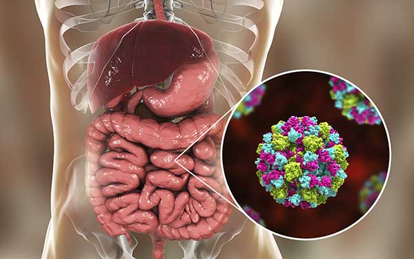Çfarë duhet të bëni kur jeni të sëmurë me norovirus ose me ‘grip të stomakut’