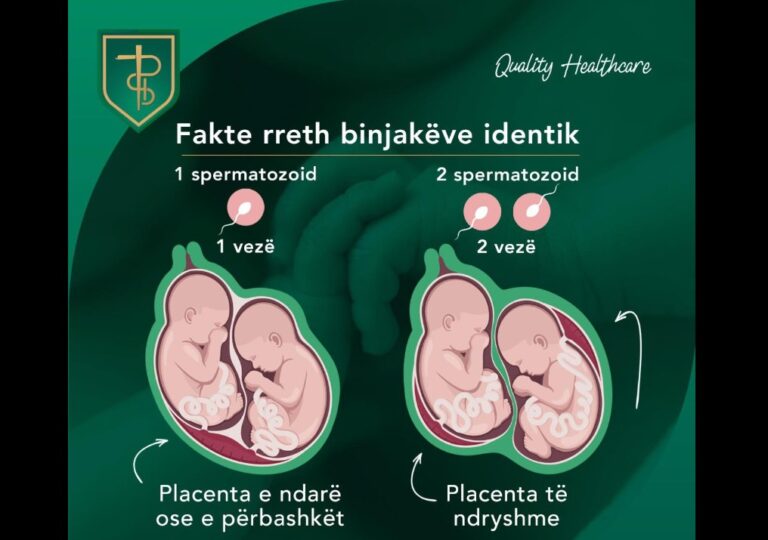 Dallimi midis binjakëve dhe binjakëve identikë