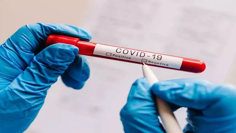 Brenda 24 orëve asnjë rast me COVID-19, vetëm 19 raste aktive në nivel vendi