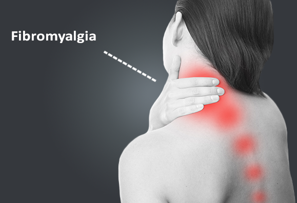 Fibromialgjia lidhet me rrezikun e rritur të vetëvrasjeve, aksidenteve dhe infeksioneve