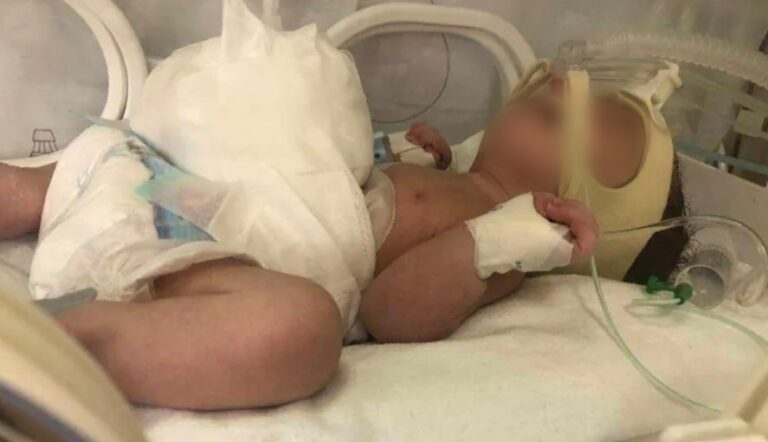 Kërkohet ndihmë për shërimin e foshnjës, familja ka nevojë për 30 mijë euro