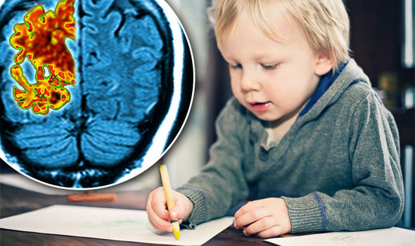 ”Alzheimer në fëmijëri”: Shenjat dhe simptomat fillestare që duhet t’i vini re tek fëmija juaj