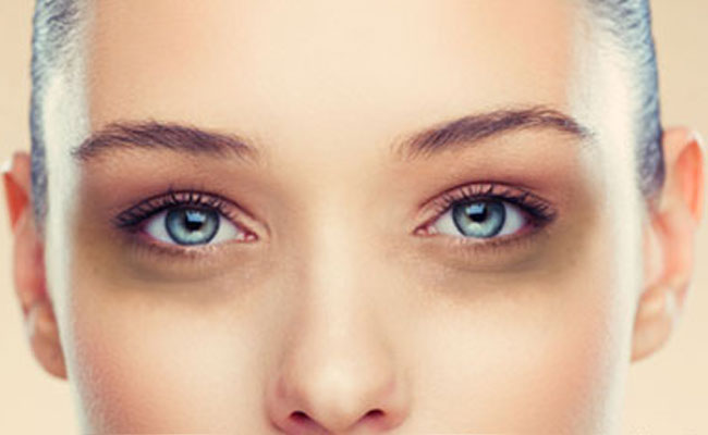 5 mangësi vitaminash që mund të shkaktojnë rrathë të errët nën sytë tuaj