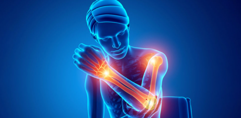 Ju dhembin kockat kur prishet koha? Trupi juaj po ju paralajmëron se vuani nga Osteoartriti