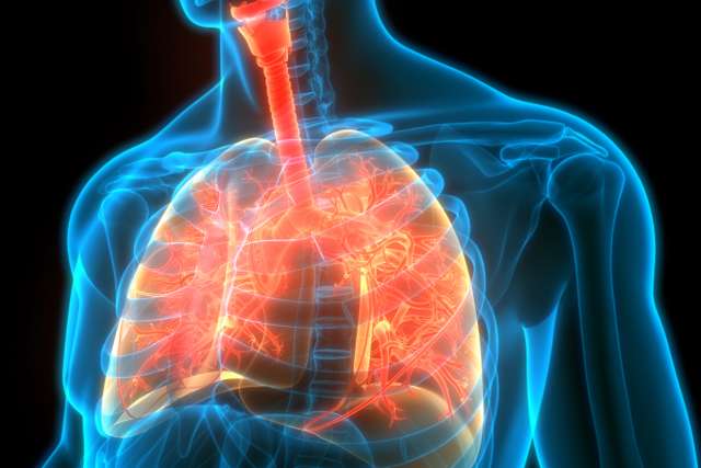 Fibroza cistike: Pse infeksionet vazhdojnë pavarësisht terapisë