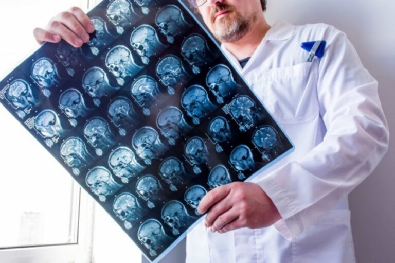 Disa nga sëmundjet që mjekët shpesh i diagnostikojnë gabimisht