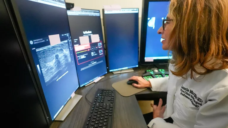 A do t’i zëvendësojë AI radiologët apo do t’i bëjë ata më efikas?