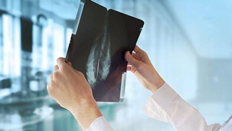 Teknologjia AI mund të ndihmojë në zbulimin e kancerit të gjirit dhe eliminimin e biopsive të panevojshme