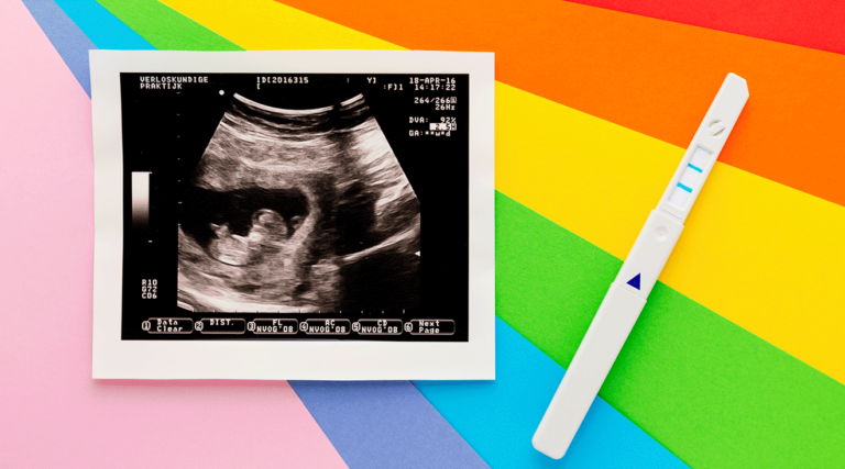 Çfarë kuptojmë me një ”bebe Rainbow”