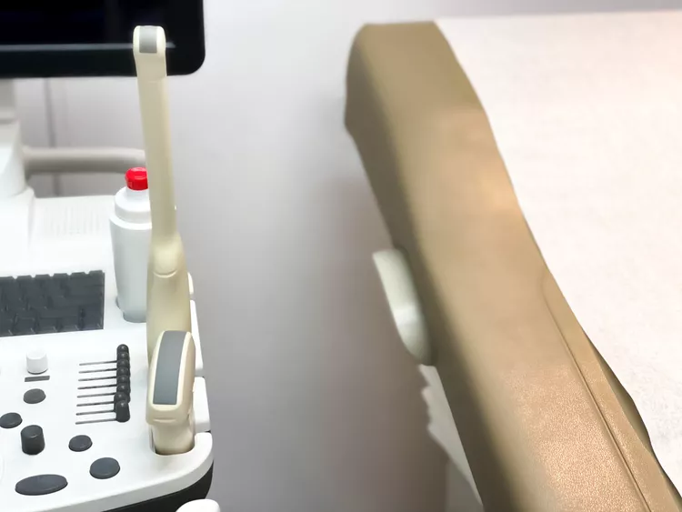 Çfarë duhet të presësh pas një aborti