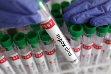 OBSH: Pothuajse 30,000 raste të dyshuara me mpox në Afrikë këtë vit
