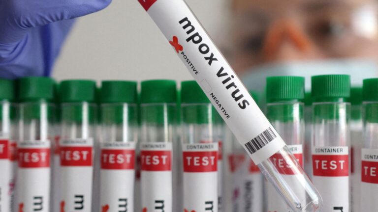 Zbulohet një variant më i rrezikshëm i virusit Mpox në tre persona në Kaliforni