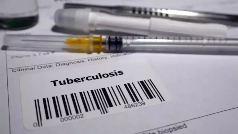 Përhapja e tuberkulozit: Zyrtarët shëndetësorë të Kansasit raportojnë 67 raste që nga fillimi i janarit