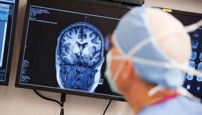 Aktiviteti jonormal në tru tek epilepsia mund të parashikohet një sekondë më herët