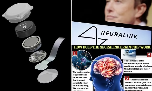 Si është të përdorësh çipin e trurit të Elon Musk dhe si funksionon?