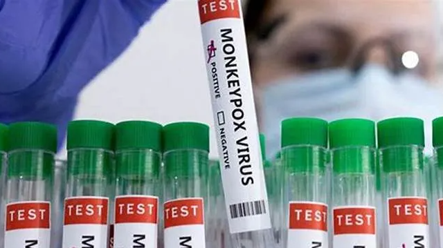 Departamenti i Shëndetësisë në New York konfirmon rastin e parë të llojit të ri të mpox