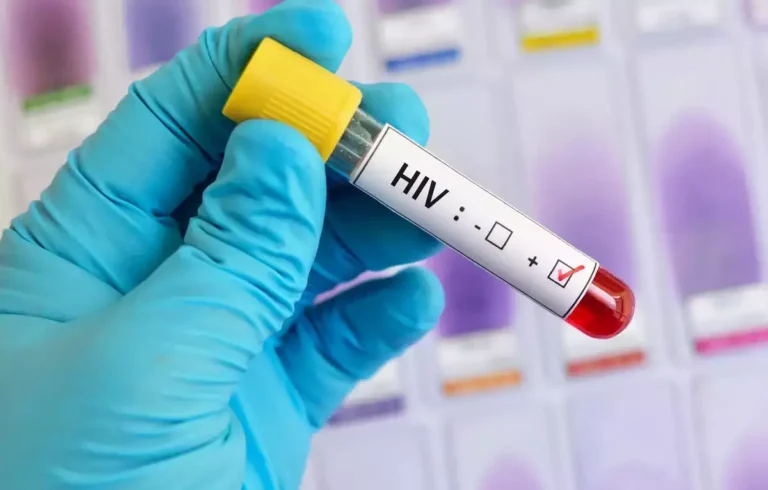 Antitrupi i ri bispecifik kundër HIV-it tregon rezultate premtuese në provën e parë klinike te njerëzit