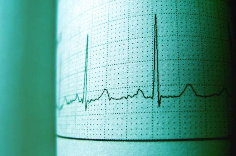 Inteligjenca artificiale lexon rezonancën e zemrës pa etiketime manuale, tejkalon modelet e zakonshme me 35%
