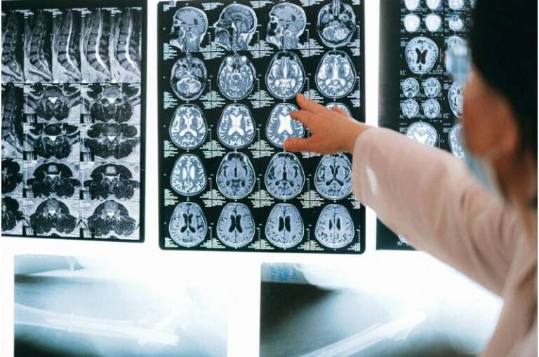 Teknologjia AI që po ndryshon mjekësinë mund të sjellë probleme ligjore për mjekët