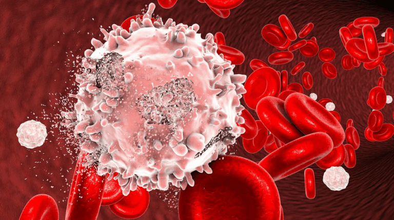 Shoqëria për Leukeminë dhe Limfomën ndryshon emrin në “Blood Cancer United” për të mbështetur pacientët me kancer të gjakut