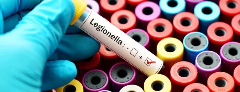 Studimi australian zbulon se bakteret Legionella mund të gjenden edhe në dhe, jo vetëm në kondicionerë dhe kullat e ujit