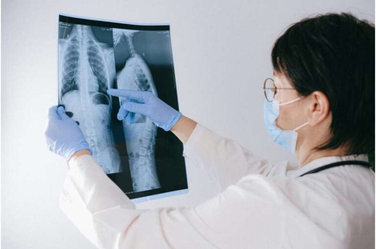 Steroidet mund të përdoren si trajtim plotësues për tuberkulozin
