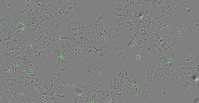 Shkencëtarët spanjollë zbulojnë një proteinë bakteriale që mund të shkatërrojë qelizat kancerogjene