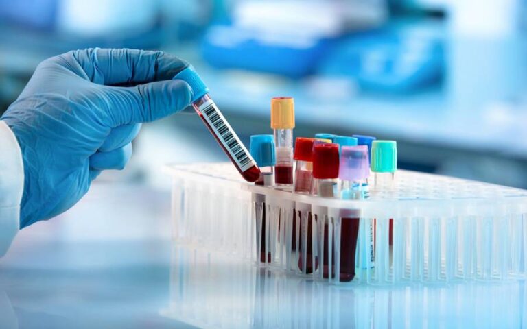 Mbi 1 milion analiza laboratorike u kryen në Spitalin e Përgjithshëm në Pejë gjatë vitit 2025