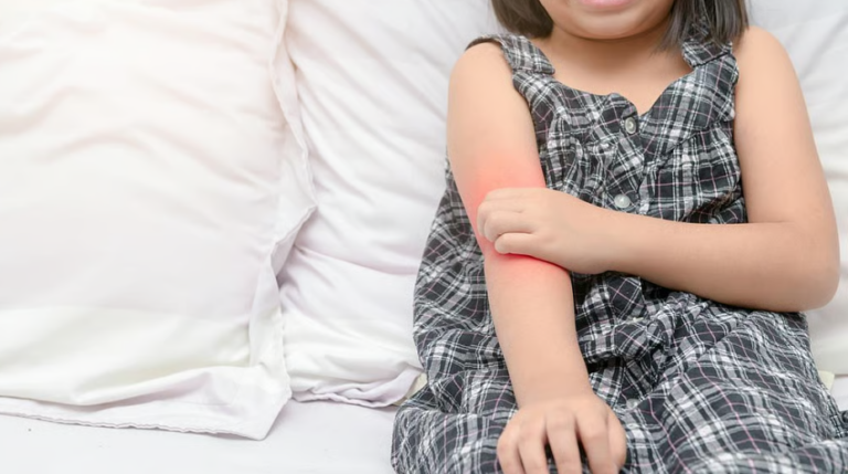 Udhëzime të reja: Ekzema tek fëmijët nuk mund të parandalohet, por trajtimi është i mundur