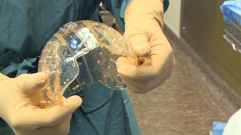 Organet bioartificiale mund të revolucionarizojnë transplantet